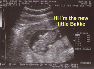 LittleBakke.JPG (229816 bytes)